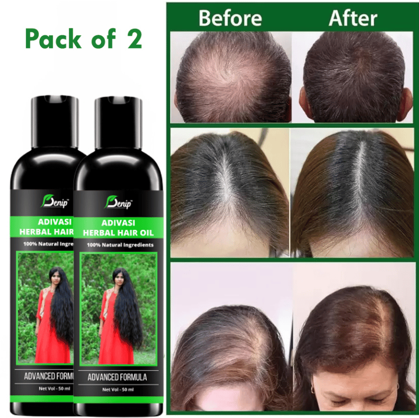 Denip Adivasi Hair Oil, for Hair Growth and Regrowth (Pack of 2) view 2