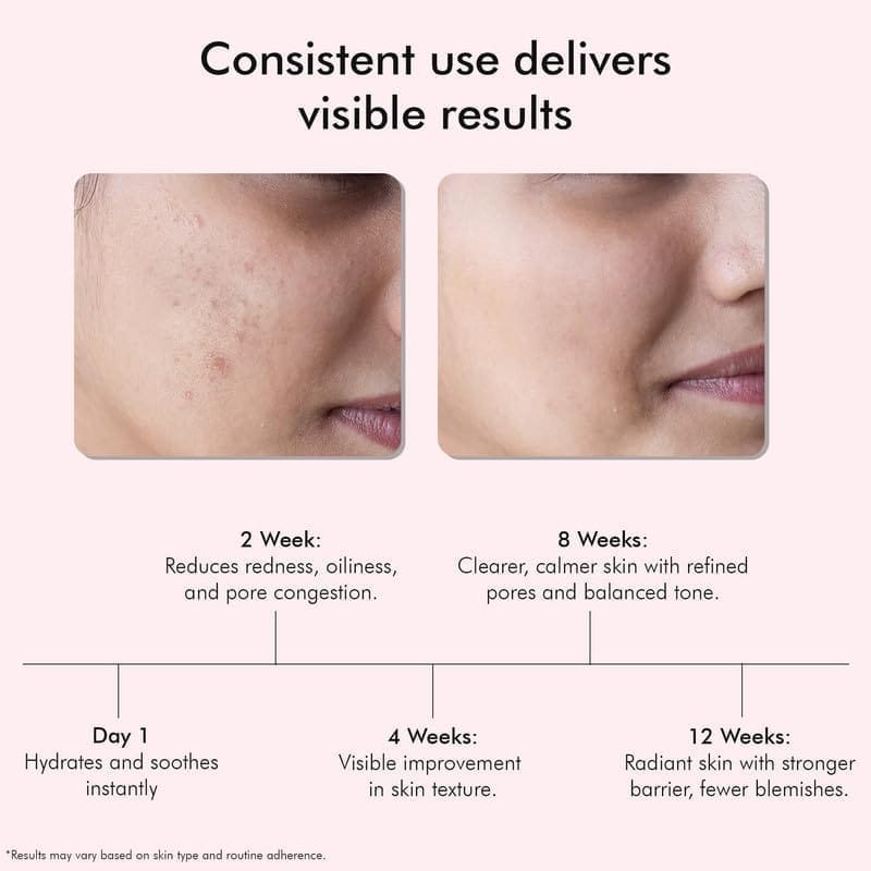VEDICDERM Red Vine Deep Facial Cleanser 100ml | pH-Balanced Face Wash For Acne, Rosacea, Eczema, Aging & Sensitive Skin | Ceramides & Peptides For Barrier | Sulfate, Paraben & Alcohol-Free (Pack of 1) view 2