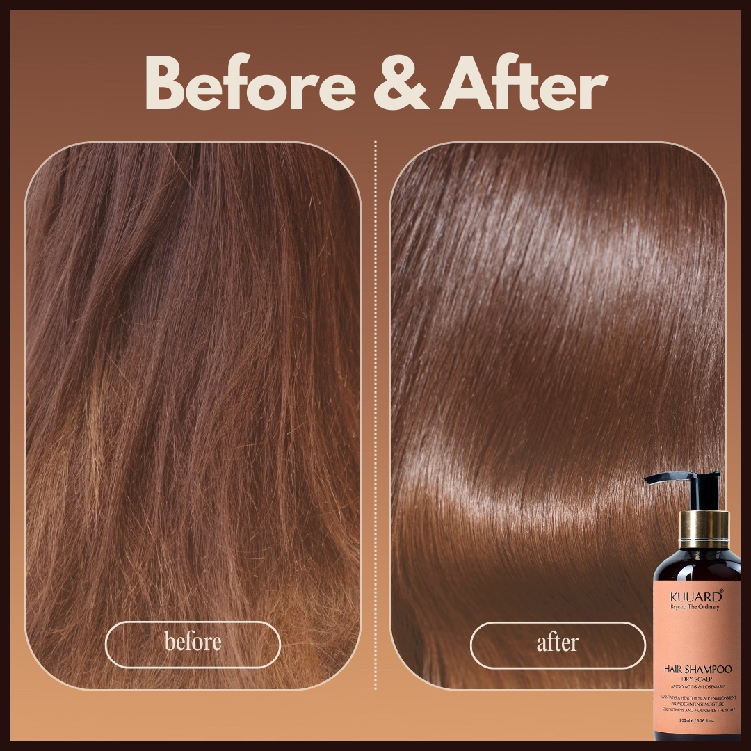 Kuuard Dry Hair Shampoo And Dry Hair Conditioner | 200ml + 200ml view 2