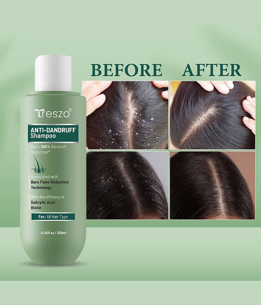 Treszo Anti Dandruff Shampoo & Conditioner 250 ml ( Pack of 1 ) view 2