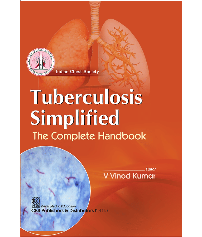 Tuberculosis Simplified: The complete Handbook