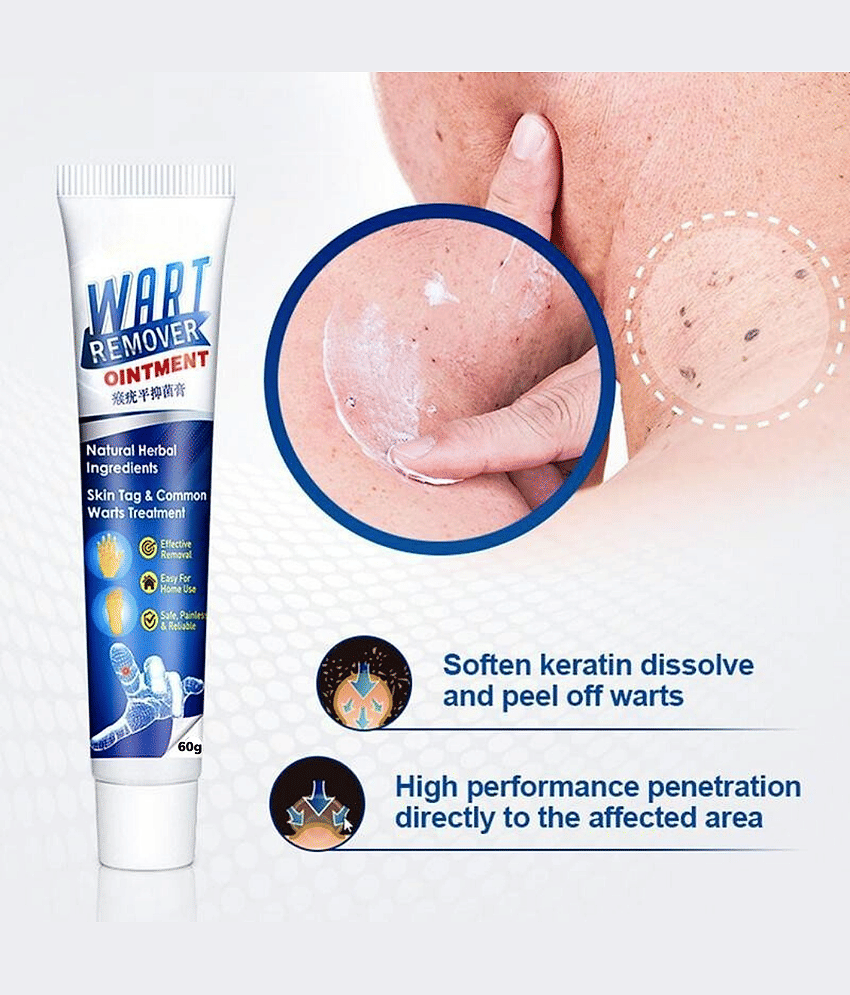 Wart Removal Ointment Treatment for Remove Warts Moles & Acne Safely Painless view 2
