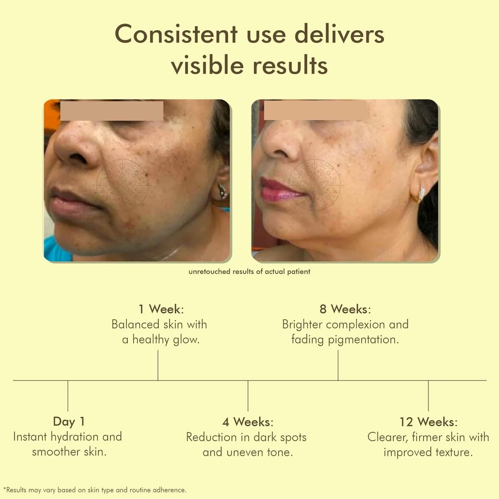 VEDICDERM Kumkumadi De-Pigmentation Night Cream 50g | Goodness of Saffron & Ceramides | Reduces Pigmentation, Dark Spots & Melasma | Evens Skin Tone & Enhances Radiance | Sulfate & Paraben Free view 2