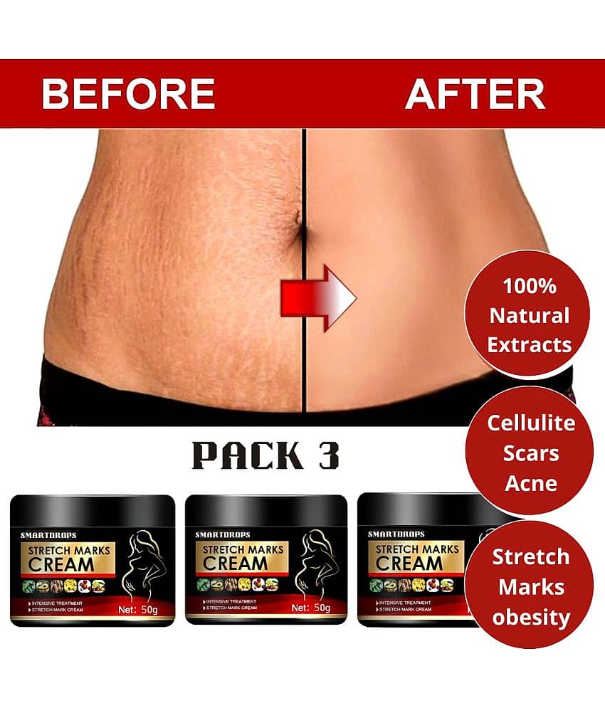 Smartdrops Pragnancy Stretch Mark Remove Cream Shaping & Firming Cream 50 g - Pack of 3 view 2
