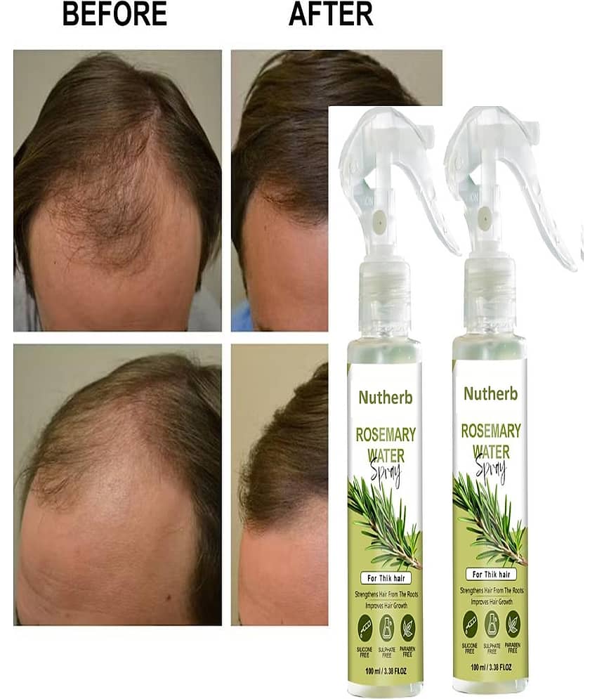 Treszo Rosemary Hair Growth Hair Serum 100 mL Pack of 2