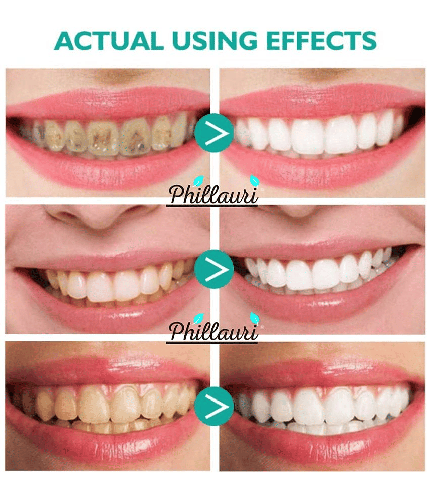 Phillauri Paraben Free Standard Oral Kit view 2