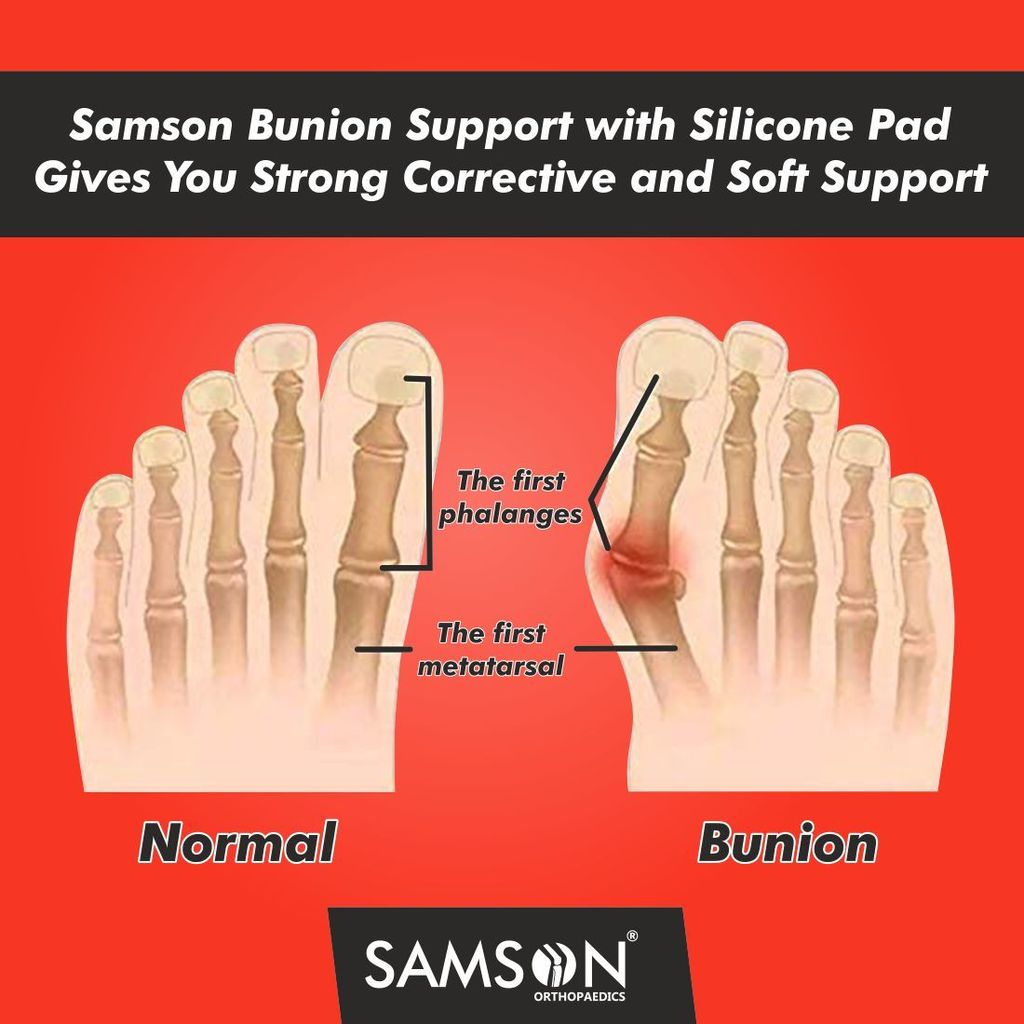 SAMSON Bunion Support with Silicone Pad (Pair) view 2
