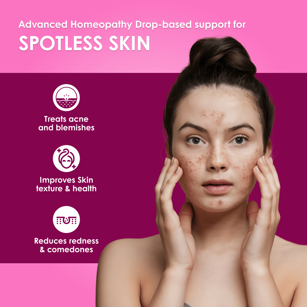 Meethi Golee Acnedonna Drops for Acne & Pigmentation Support (30ml) | Advanced Homeopathy 2.0 Skin-Regulation Formula for Breakouts, Oil Balance & Post-Acne Marks | Fast Absorbing Oral Drops for Clear Looking Skin view 2
