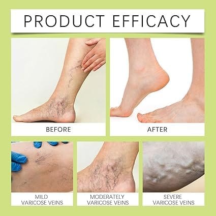 Miracle Balm Skin Moisturizing Balm | Multi-Purpose Soothing & Conditioning Daily Skin Care | Soft, Smooth & Comfortable Skin | 30g (Pack Of 1) view 2