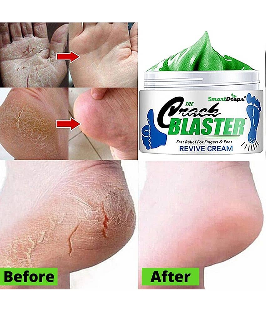 Smartdrops Smartdrops Foot Cream SPF 24 ( 150 g ) view 2
