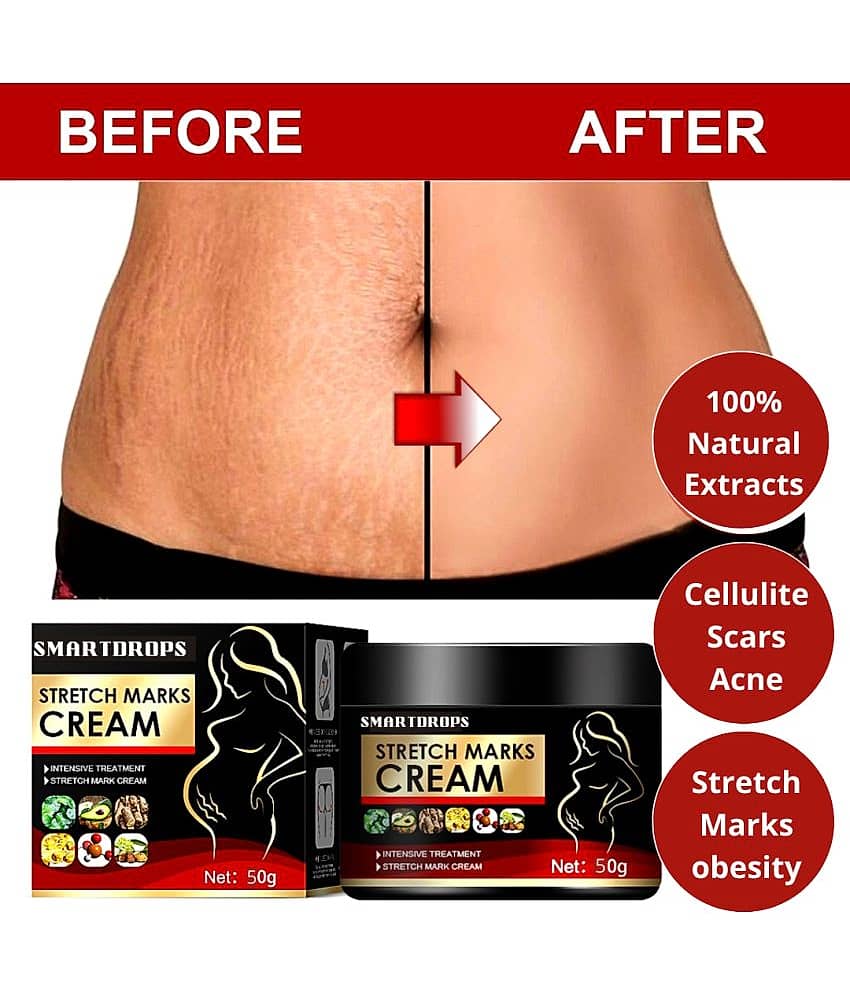 Smartdrops Pragnancy Stretch Mark Remove Cream Shaping & Firming Cream 50 g - Pack of 1 view 2