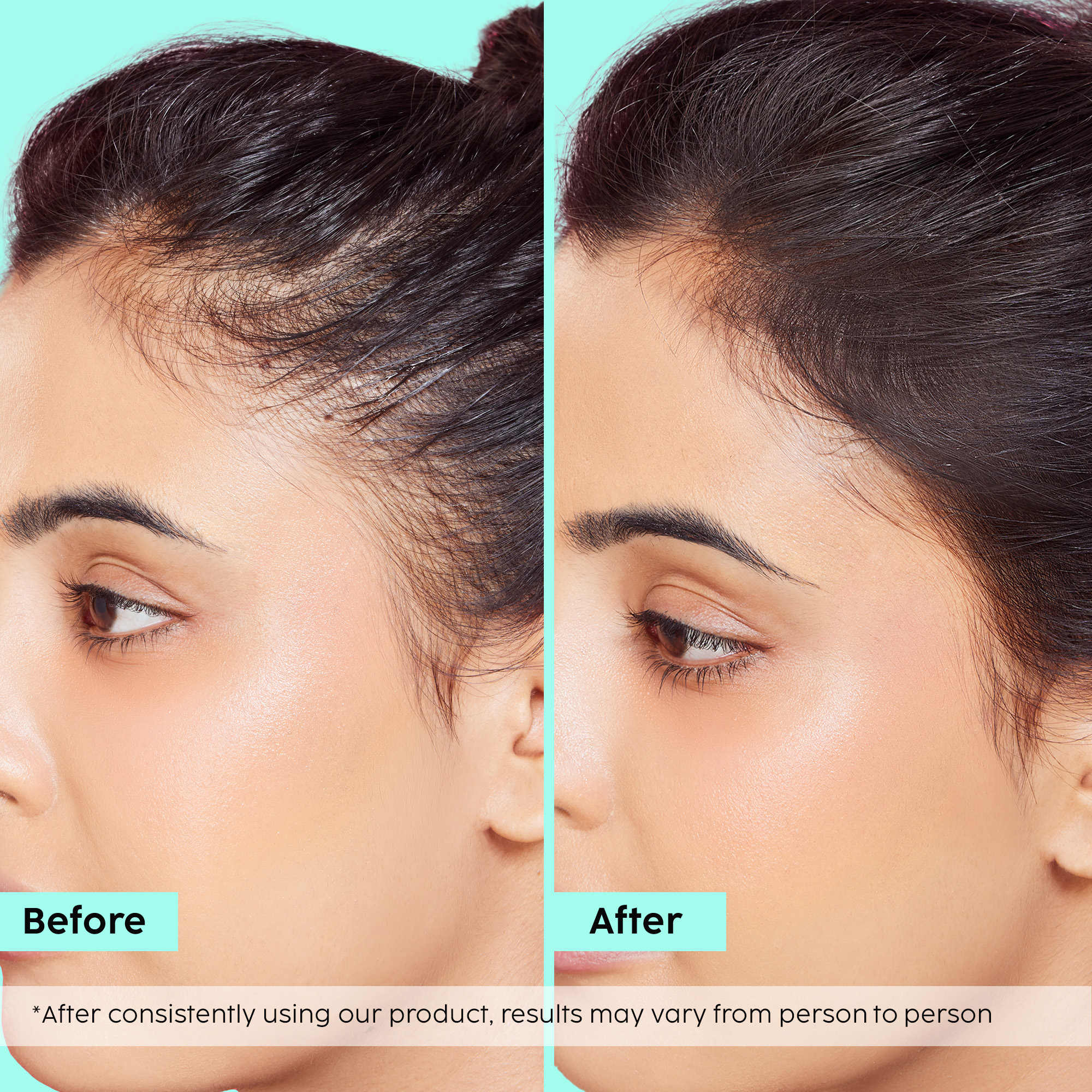 Rosemary Hair Growth Advanced Hair Oil __Starter Pack__ view 2