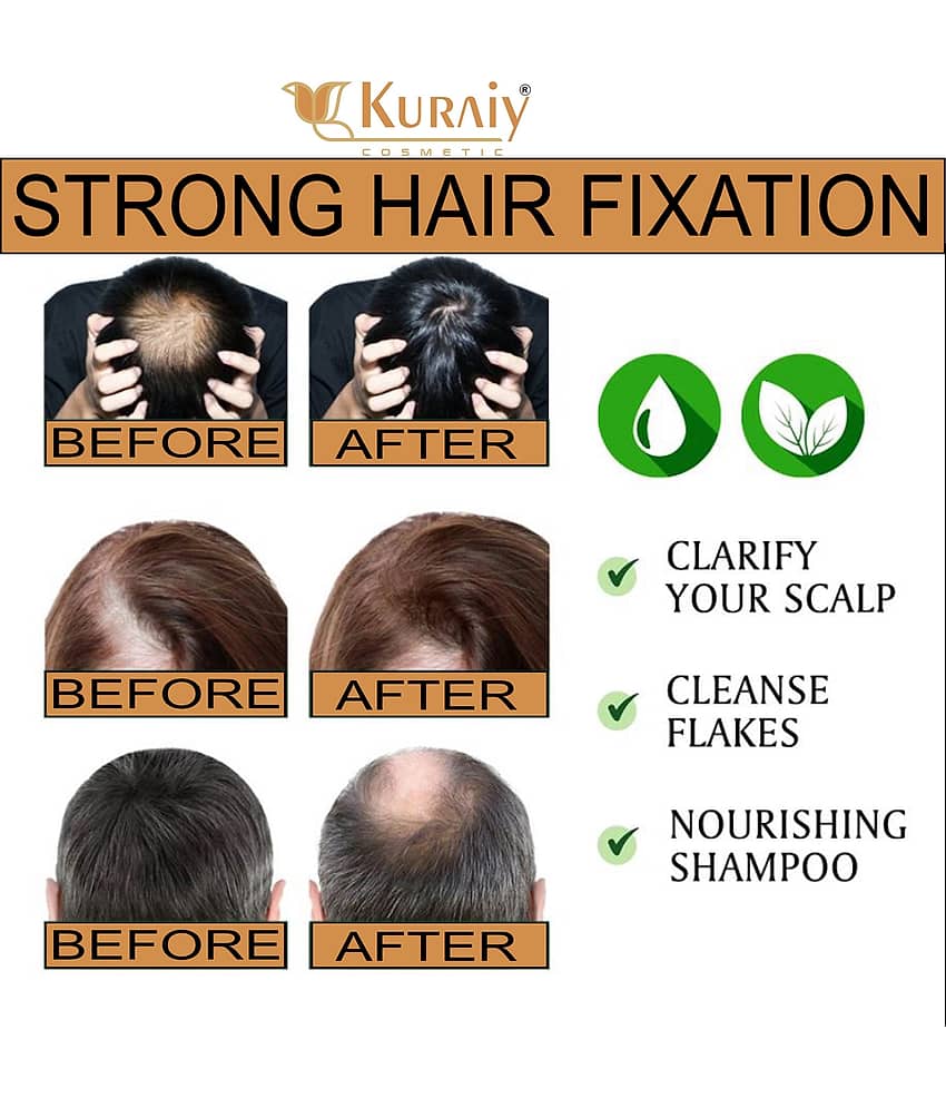 KURAIY FENUGREEK SHAMPOO FOR DEEP CONDITIONING,SILKY & SHINY HAIR 200ML view 2