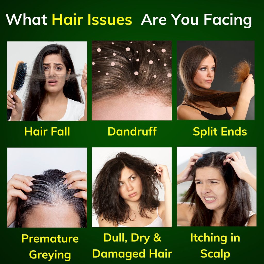 Oviya Rice Bran Ayurvedic Hair Oil || Ayurvedic Hair Oil blends 27 medicinal herbs & 7 natural oils view 2