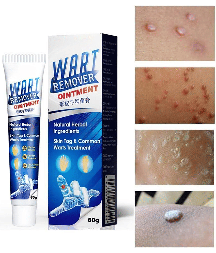Remover Wort Without Leaving scars and refuse to repeat All Skin Type Use For Men And Women