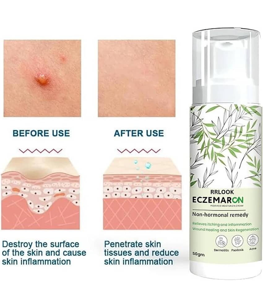 Vedlekha Moisturizer All Skin Type Tea Tree ( 100 gm ) view 2