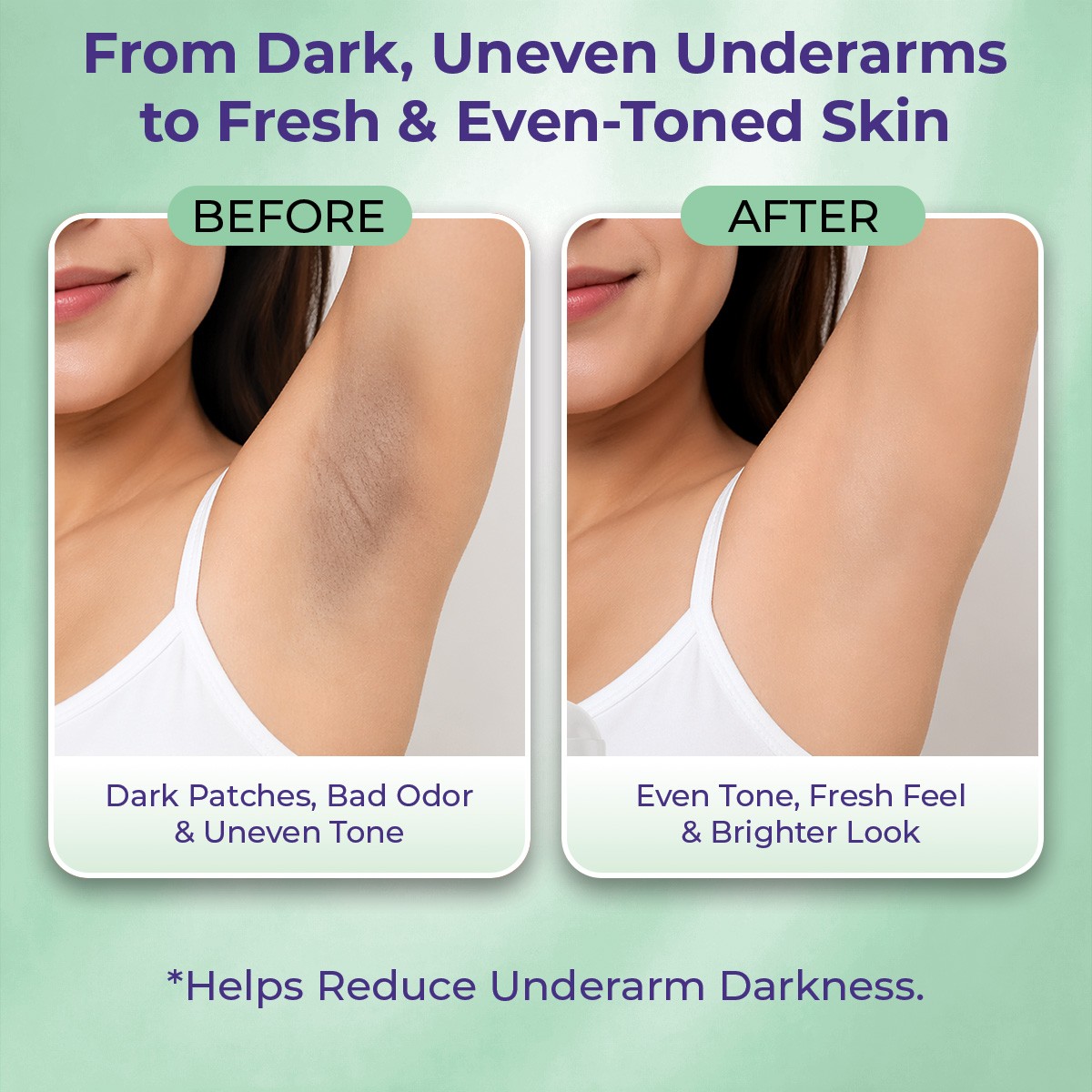 Sanfe Underarm Lightening Roll On - 50ml view 2
