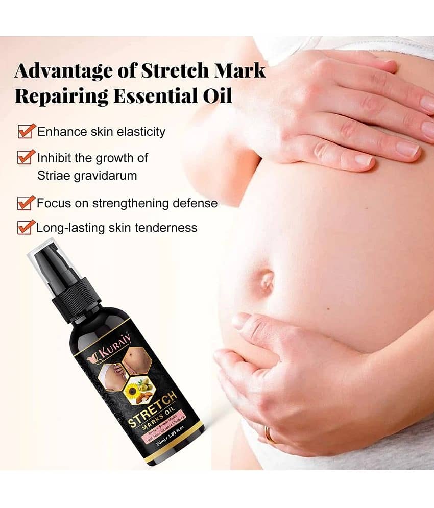 KURAIY Remove Pregnancy Mark Body Cream Treatment Scars Acne Stretch Marks Cream view 2
