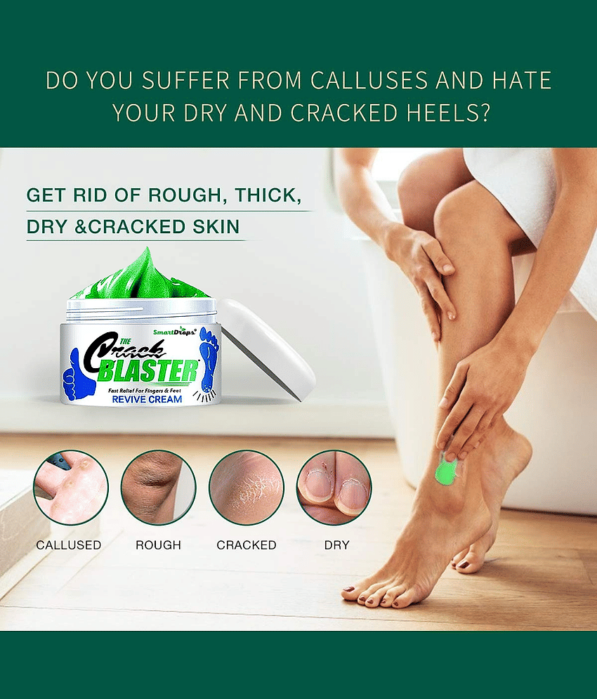 Smartdrops Nourishing Dry Cracked Foot Cream Foot Cream ( 100 g ) Pack of 2 view 2