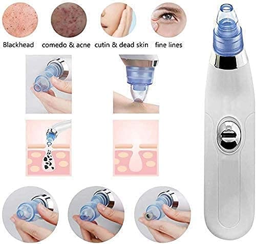 4 in 1 Multi-Function Blackhead Whitehead Extractor Remover Device, Skin Cleaner, Pimple Removal Tool, Acne Pimple Pore Cleaner Vacuum Suction Tool for Men and Women (white) view 2