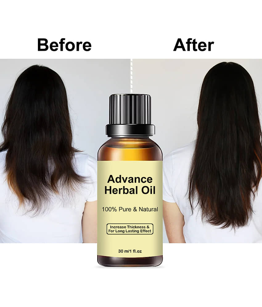 Treszo Anti Hair Fall Coconut Oil 30 ml ( Pack of 1 )