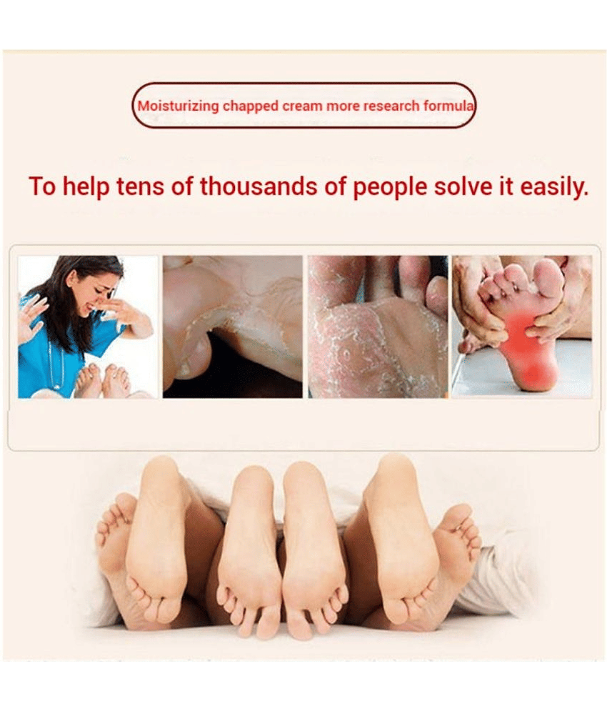 Smartdrops Fast Rellef For Fingers & Feet Crack Cream Foot Cream SPF 15 ( 100 g ) Pack of 2 view 2