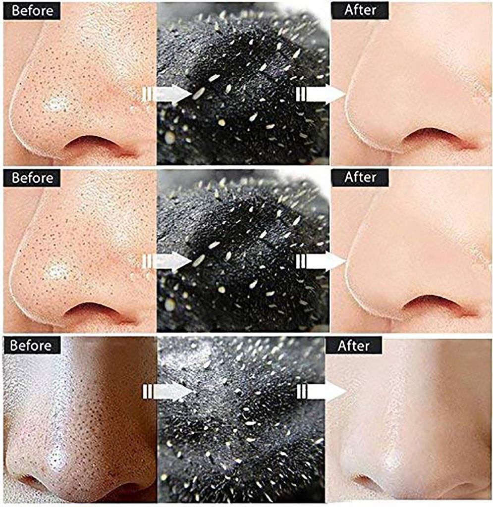 Activated Charcoal Deep Detox Body Cream (एक्टिवेटेड चारकोल डीप डिटॉक्स बॉडी क्रीम) Charcoal Blackhead Mask Cream for Deep Cleansing, Purifying, Removes Excess Dirt & Oil Face Mask Blackhead Remover, (pack of 2) view 2