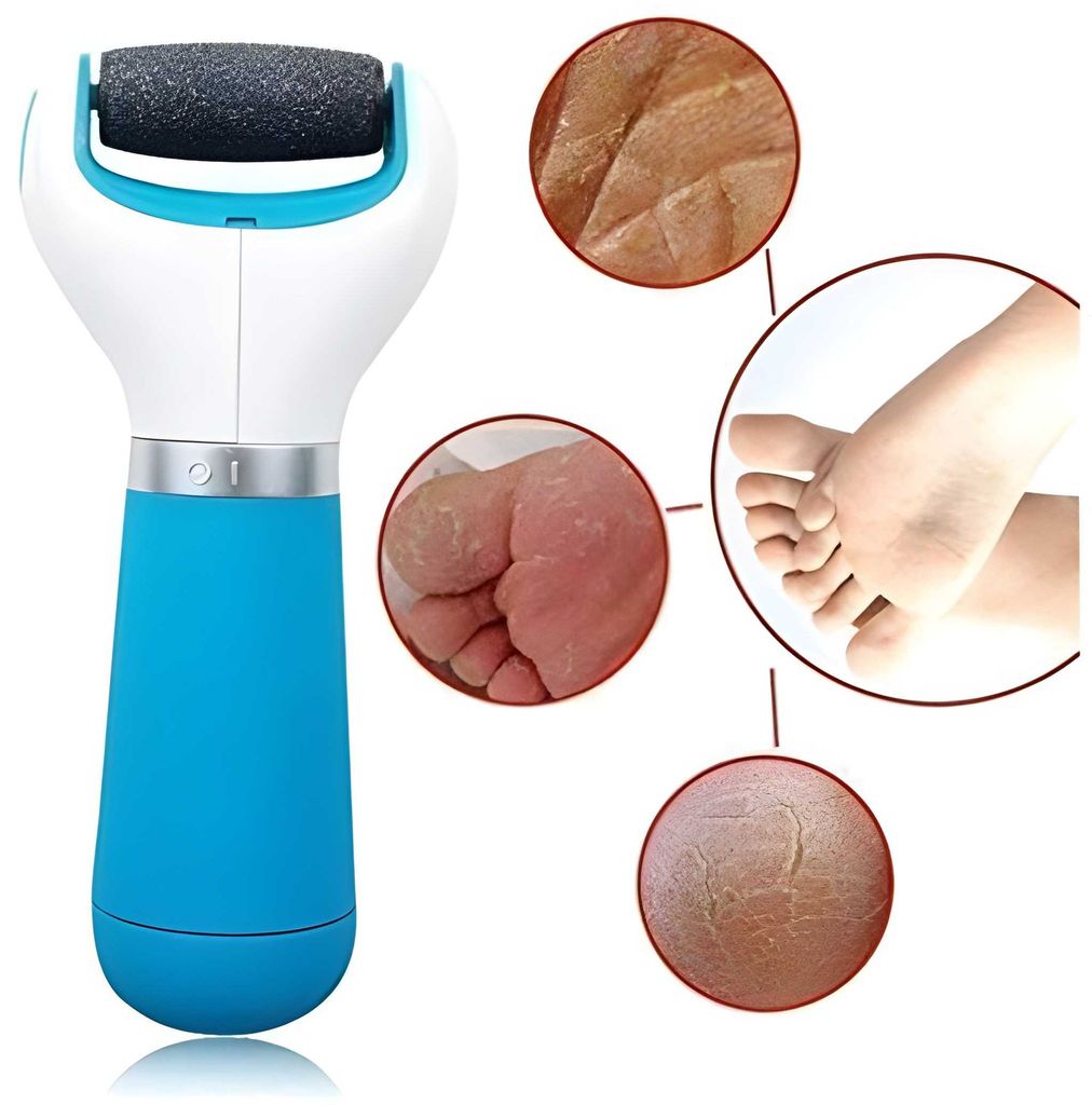 Foot Roller Callus Remover | Hard & Dead Skin Remover | Pedicure Tool for Cracked Feet | Foot Scrubber Roller (Original Quality) view 2
