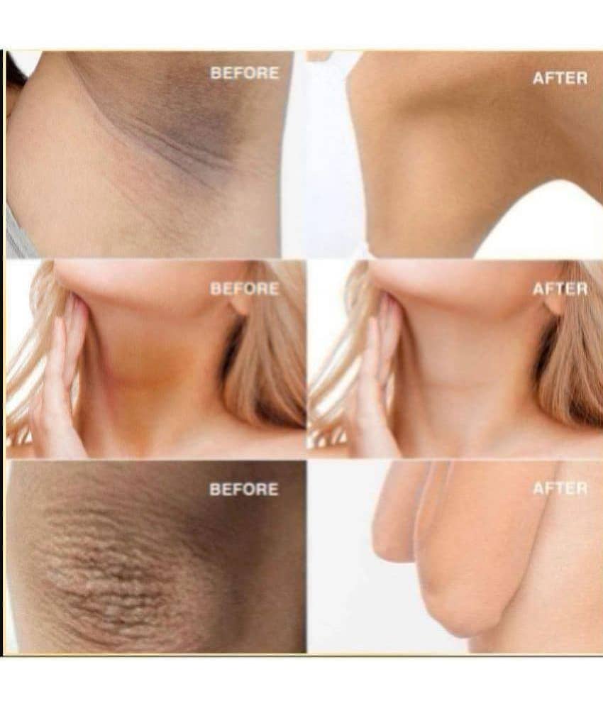 KURAIY Underarm Whitening & Brightening Cream For Remove Dark Underarm Black Spots & Wart.. view 2
