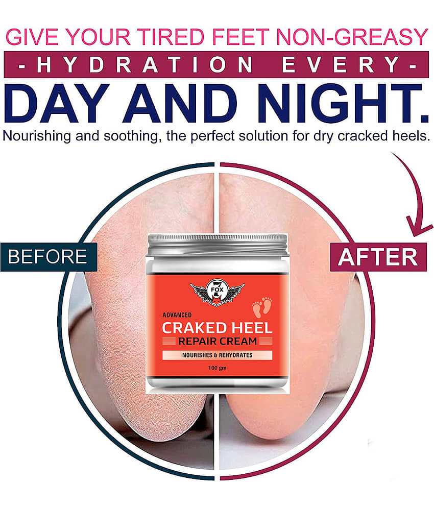 7 FOX Cracked Heel Repair Specialist Cream Smooth Feet, Foot Cream,100ml view 2